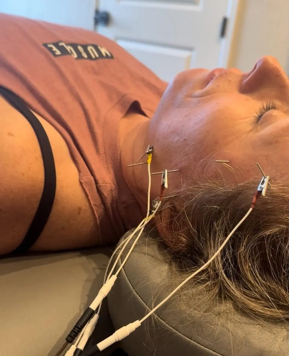 Dry Needling & Manual THERAPY Dry Needling & Manual<br />
THERAPY